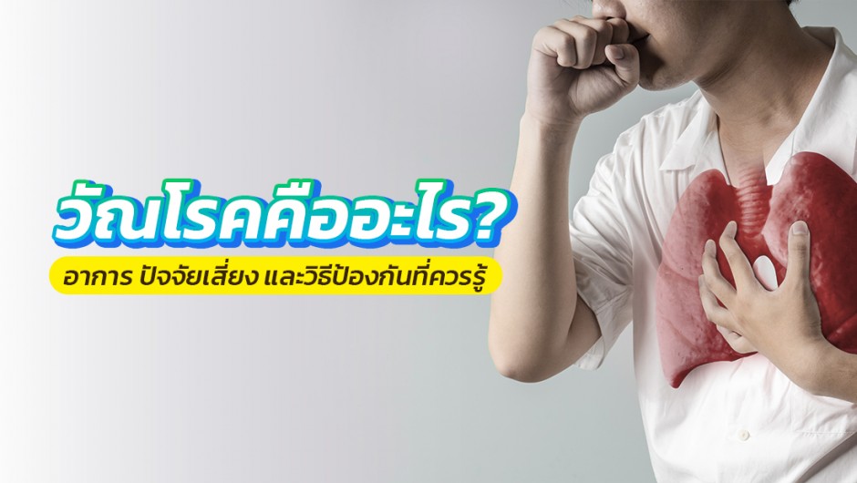 วัณโรคคืออะไร? อาการ ปัจจัยเสี่ยง และวิธีป้องกันที่ควรรู้ บทความ